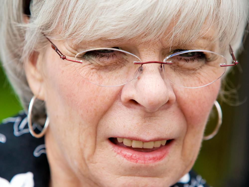 Werner's syndrome can increase the risk of getting cataracts.