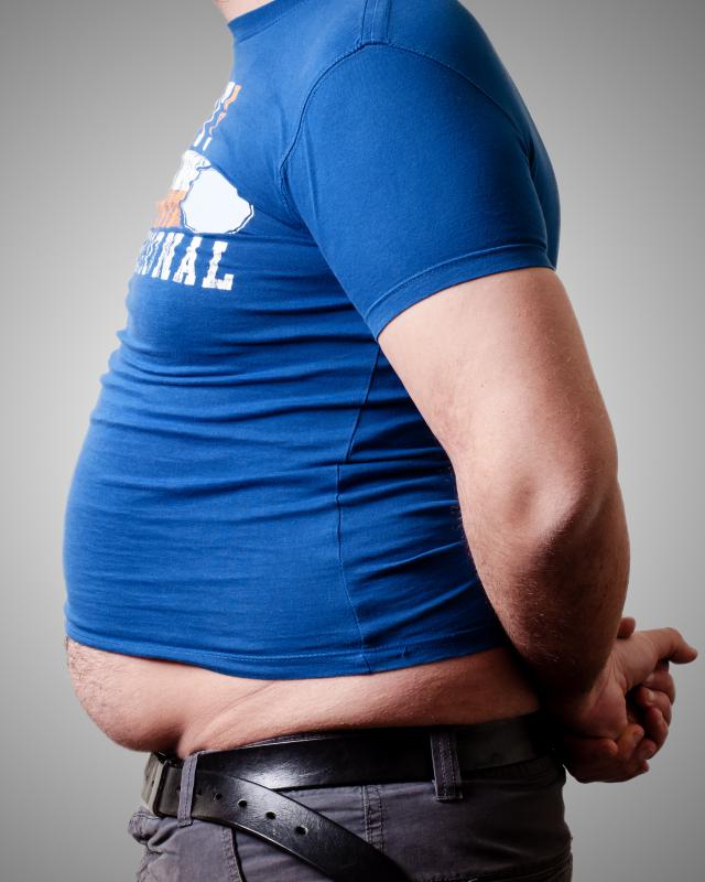 Being overweight may cause a reducible hernia.