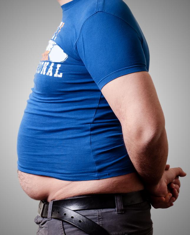 Overweight individuals may be susceptible to inguinal hernias.