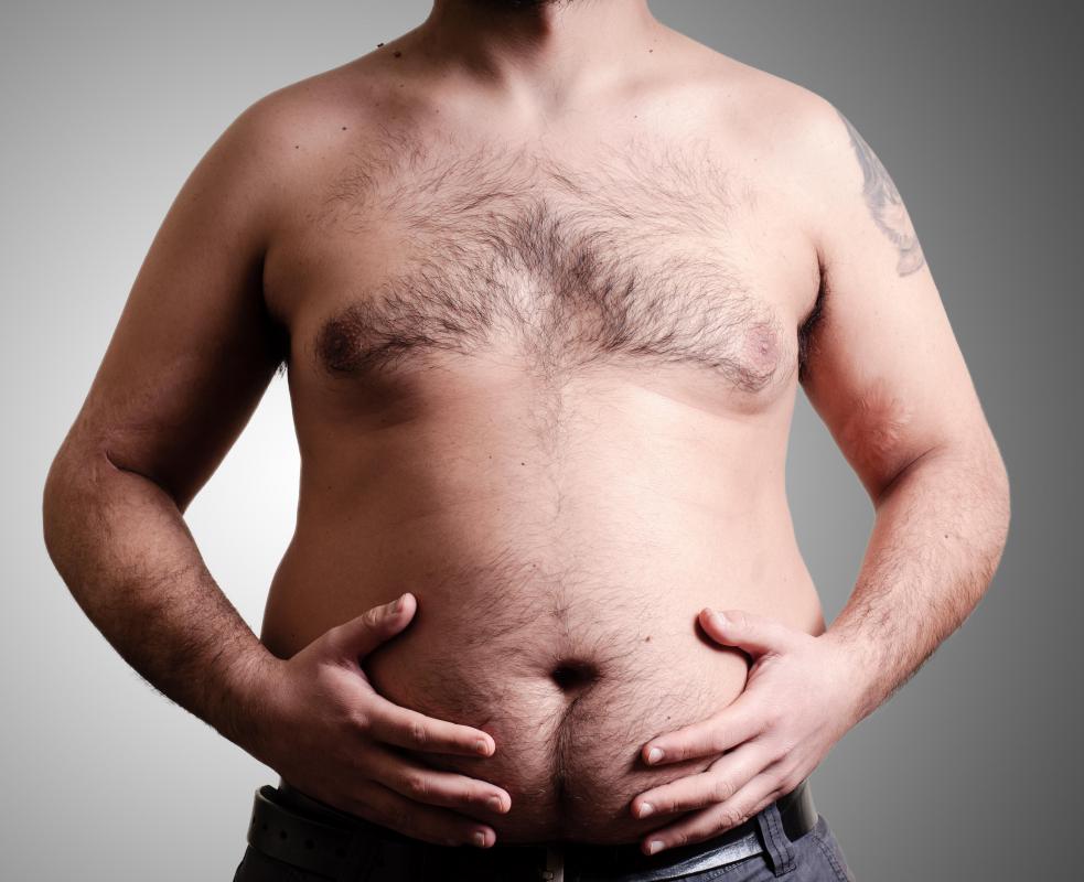 Weight gain can aggravate a direct inguinal hernia.