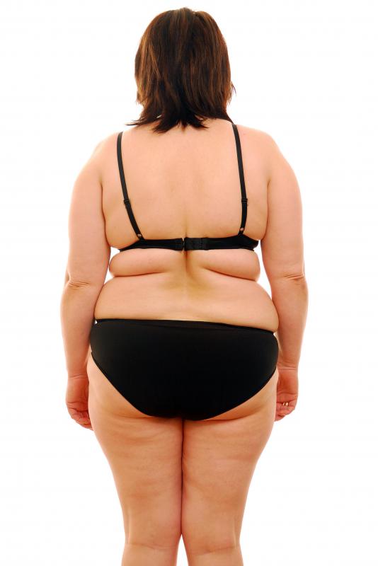 Symptoms that may be considered cushingoid may include weight gain.