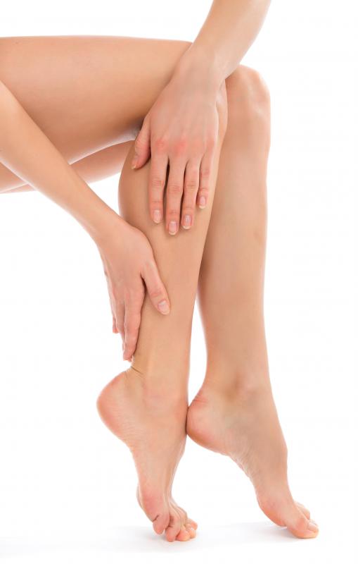 It is believed that varicose veins occur as a result of the improper function of valves in the veins.