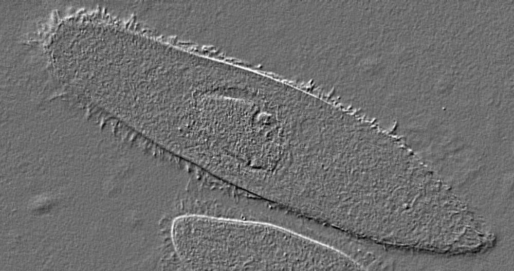Paramecium with cilia.