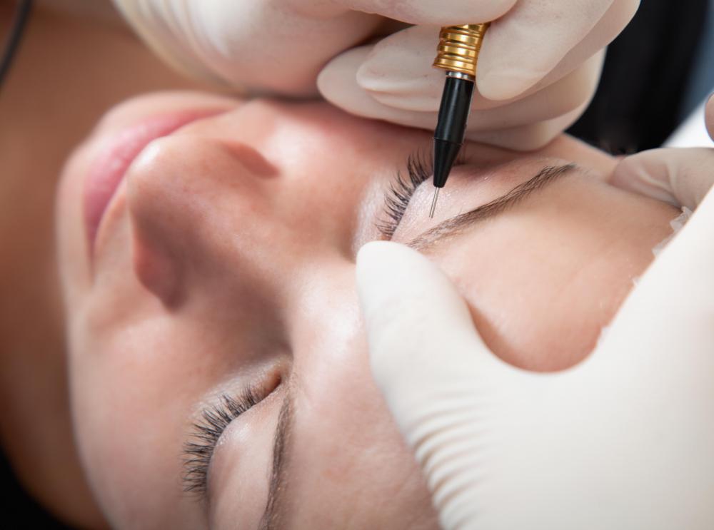 Permanent eyebrow makeup may be used to enhance the appearance of eyebrows.