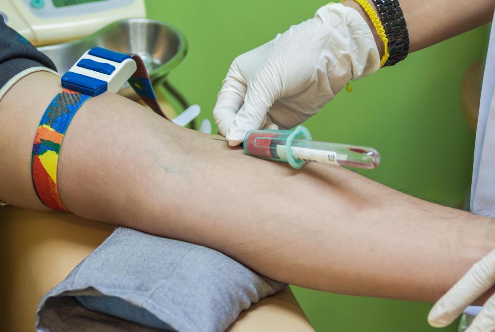There are a variety of sizes of pre-manufactured tubes that are used for drawing blood.