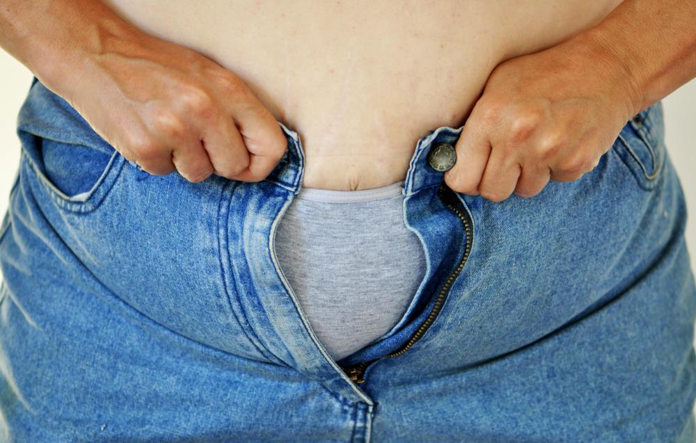 Symptoms of a Candida yeast infection may include bloating.