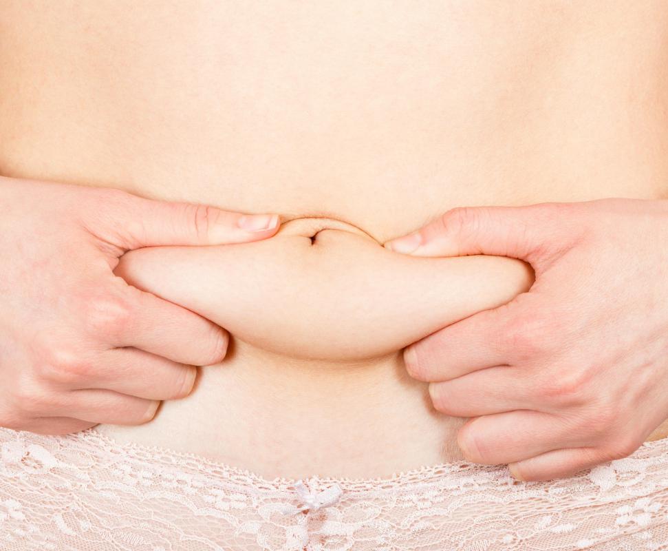 Most people associate the term "spare tire" with subcutaneous fat.