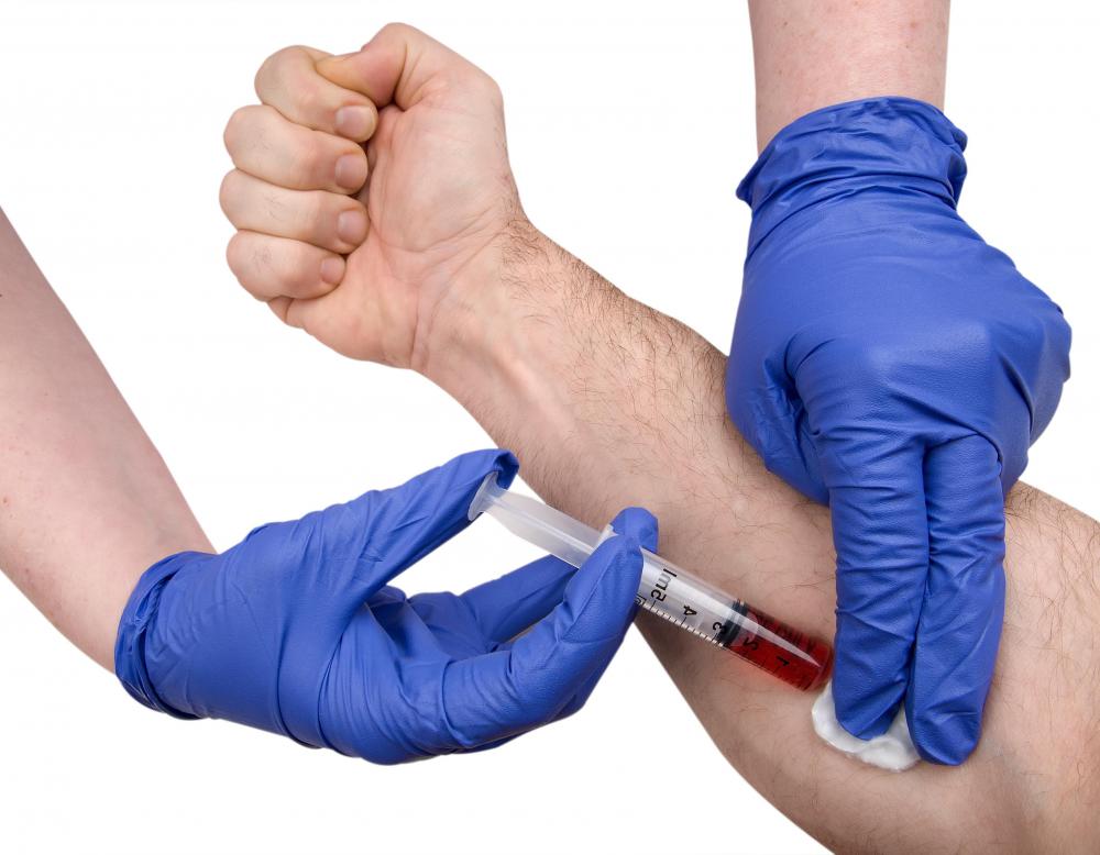 The superficial femoral artery may be used to draw blood.
