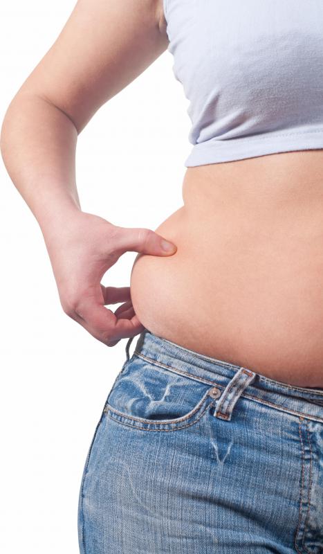 Overweight people are more at risk for experiencing erythrasma.