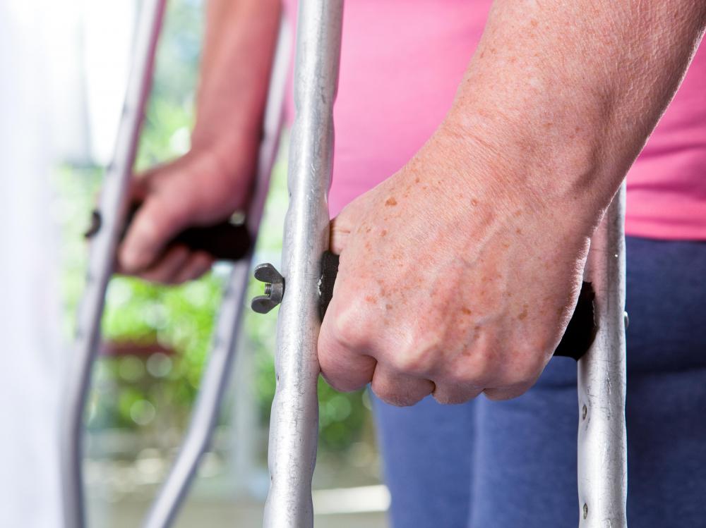 Use of crutches can be helpful following a hemipelvectomy.