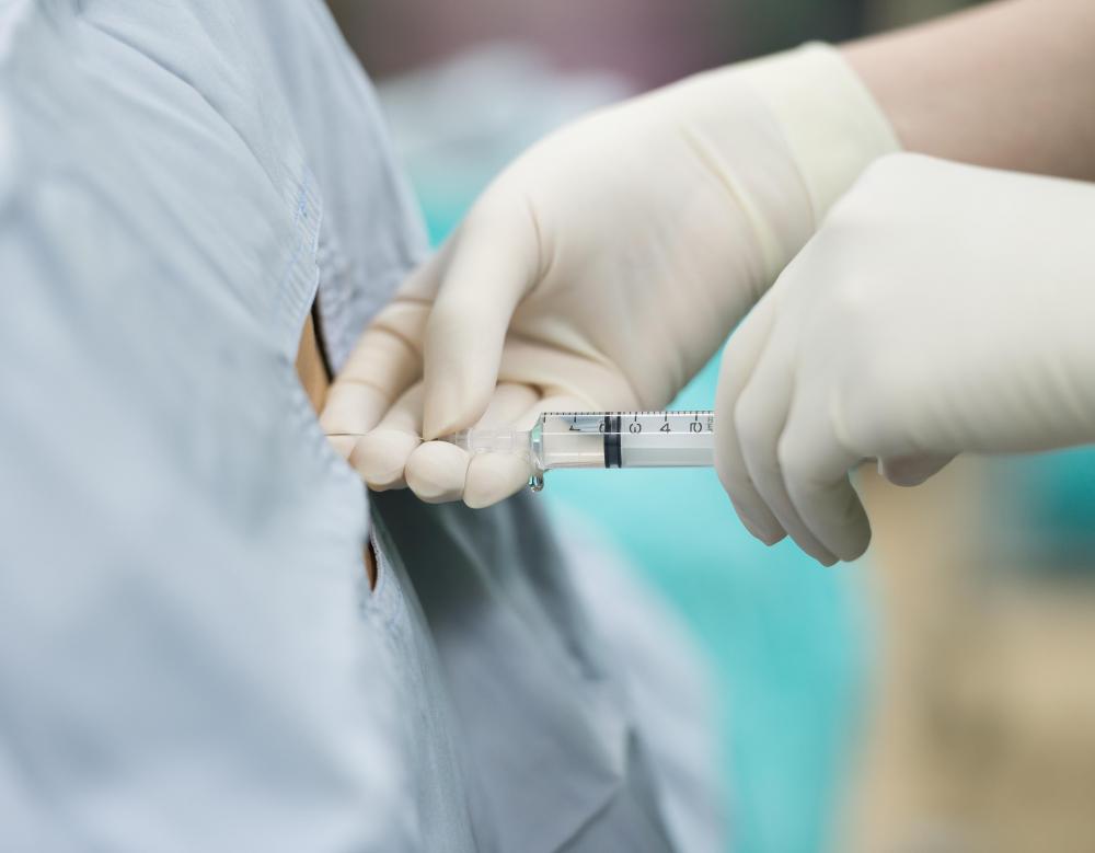 A lumbar epidural steroid injection may be able to provide short-term relief from central canal stenosis.