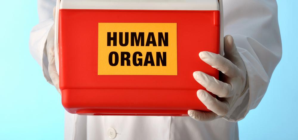 An isograft is a transplant with donor material from someone who is genetically identical to the recipient.
