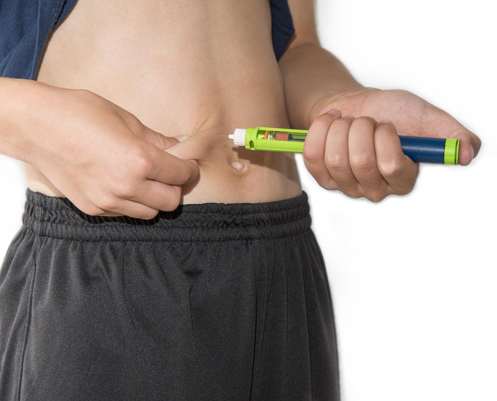 Bolus injections can be administered subcutaneously.