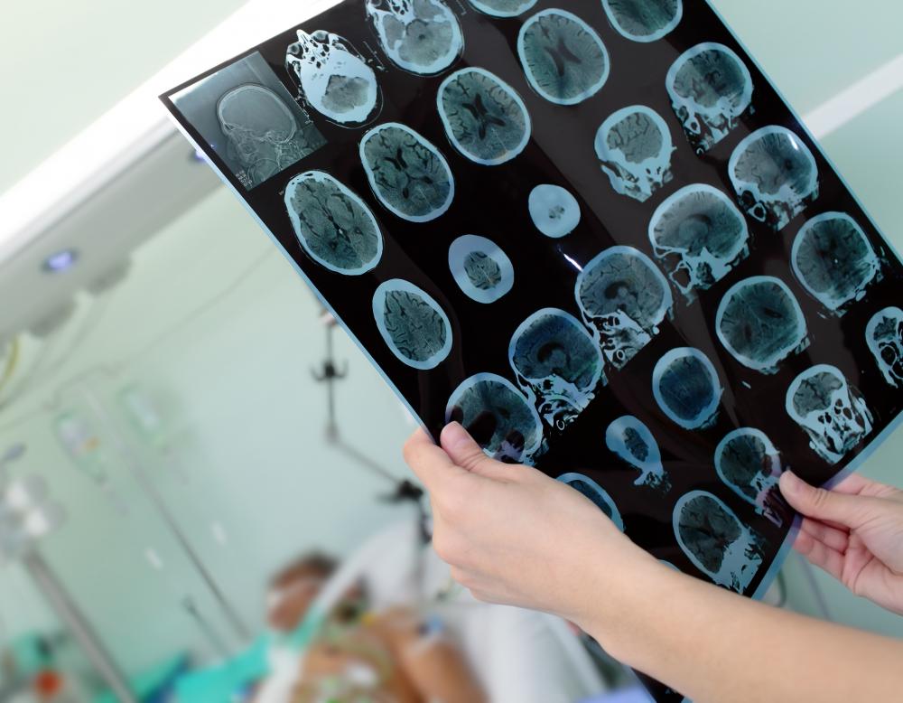Electronic medical records enable members of a health care team to coordinate patient care, which helps to avoid repeat medical testing.