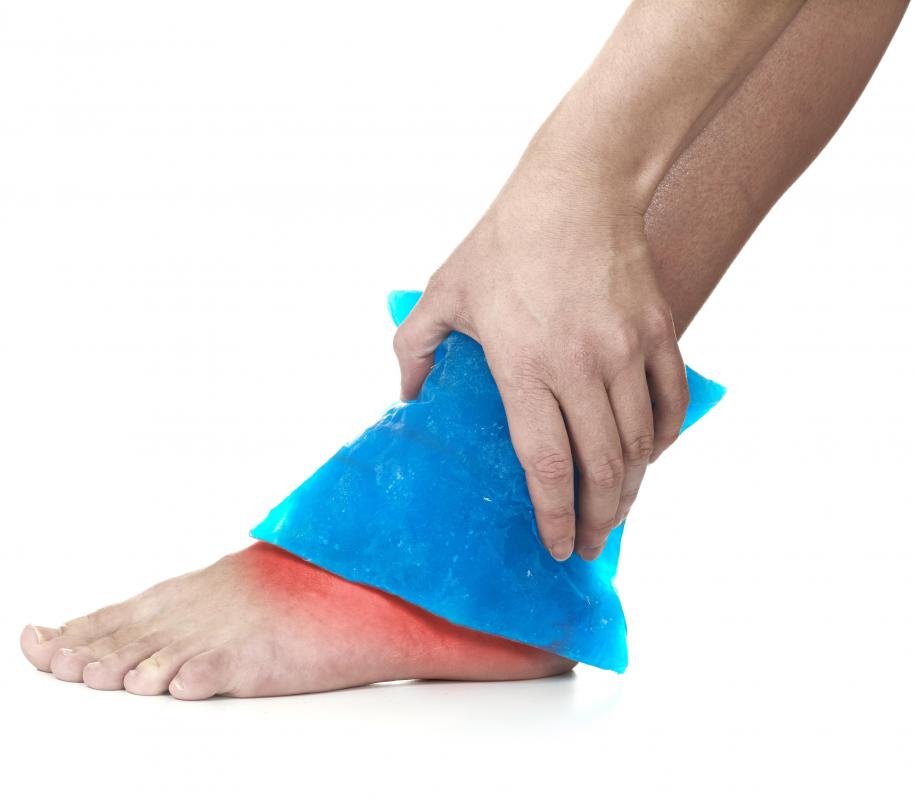 Icing is commonly used to treat ankle bone spurs.