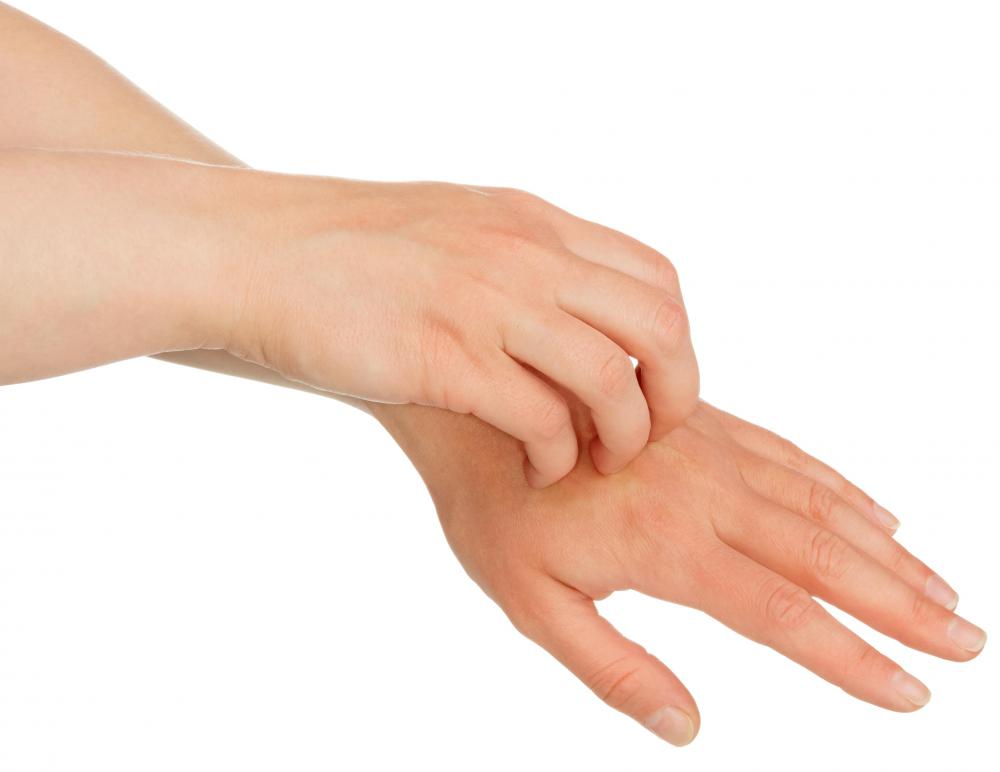 Eczema often causes skin bumps and itching.