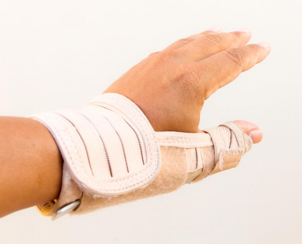A splint may be helpful in treating tenosynovitis.
