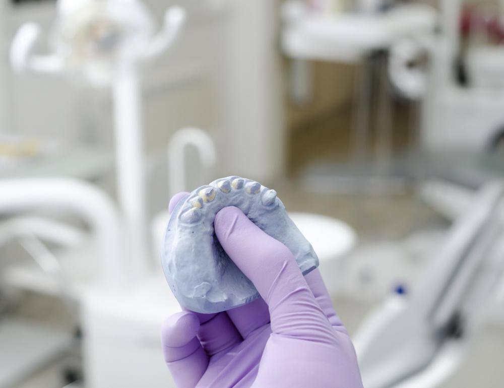 Dental implants require taking a dental impression of a patient's remaining natural teeth.
