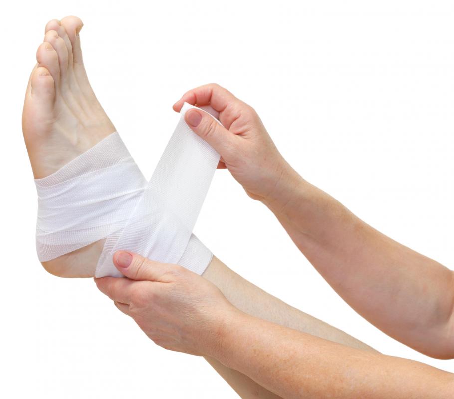 Foot injuries may cause the development of a ganglion foot cyst.