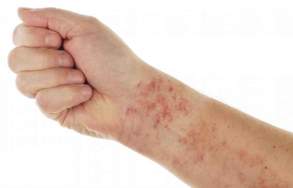 Skin changes can be a sign of concern.