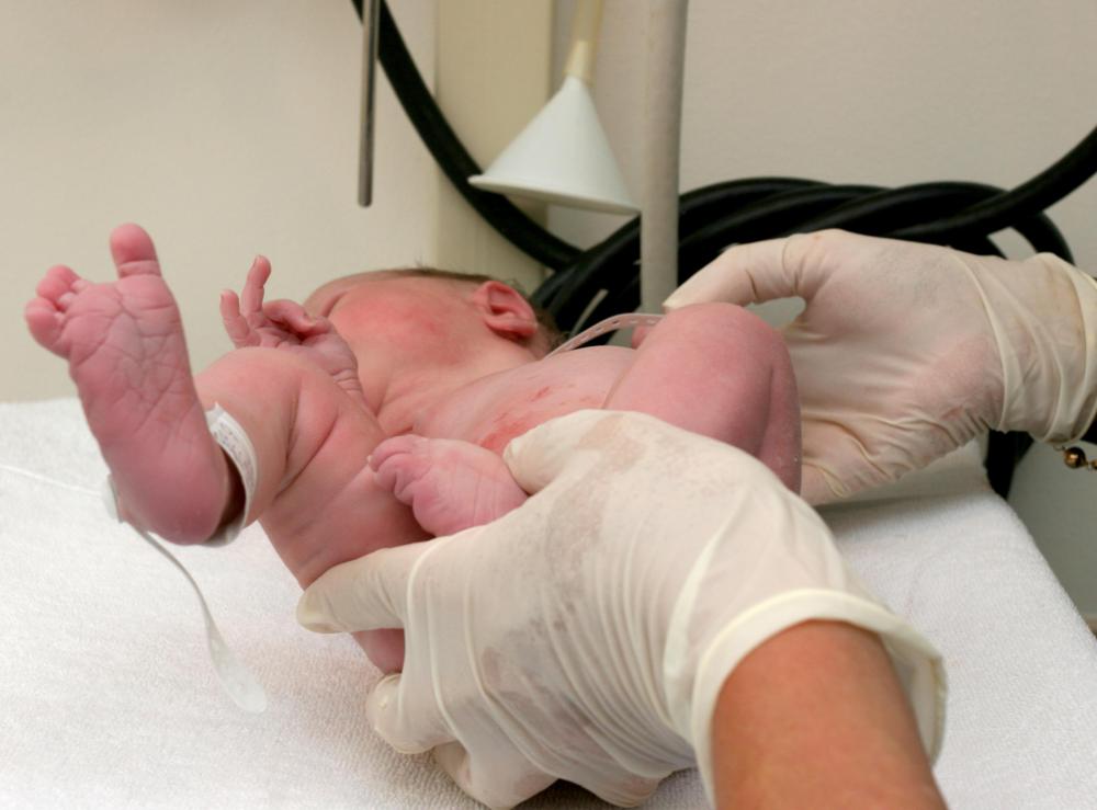In the United States and many other countries, infant foreskin removal is usually performed under local anesthesia.