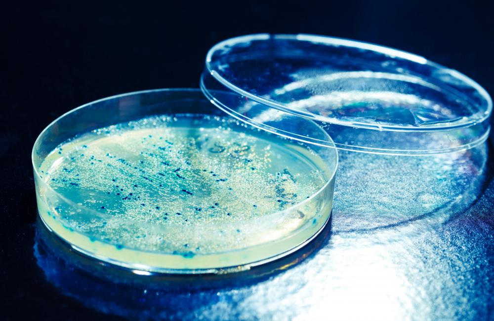 Placing bacterial cultures on a plate of agar will allow colonies to grow.