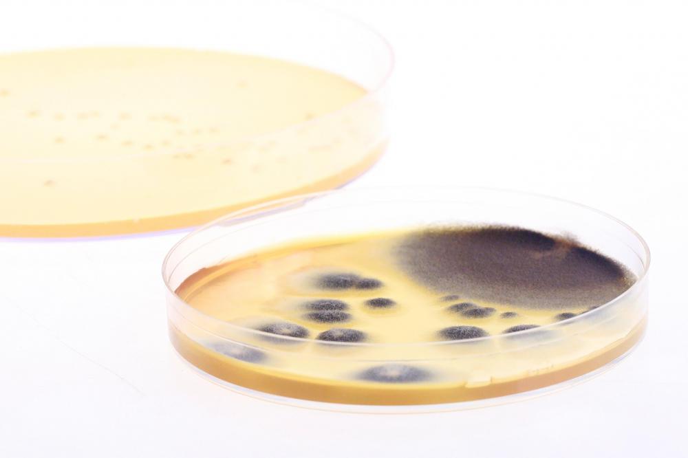 Samples collected from the back of the throat may be grown for several days before lab results are available.