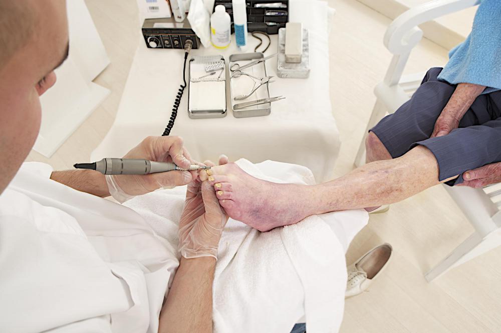 Proper foot care might require the assistance of a podiatrist.