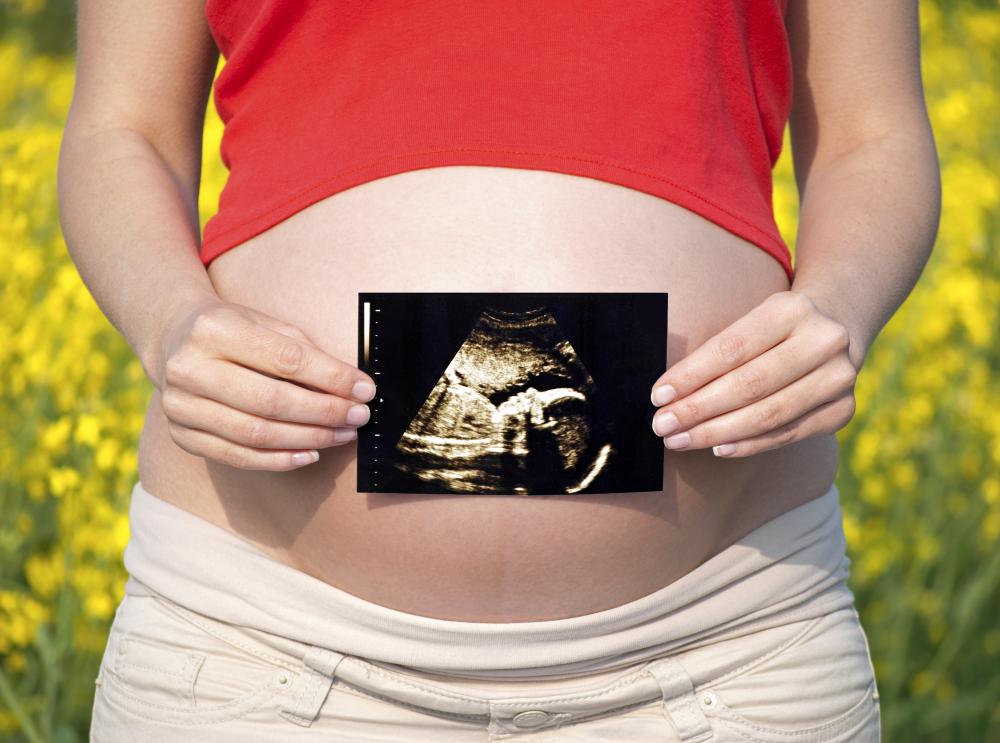 An ultrasound is the second part of maternal serum screening.