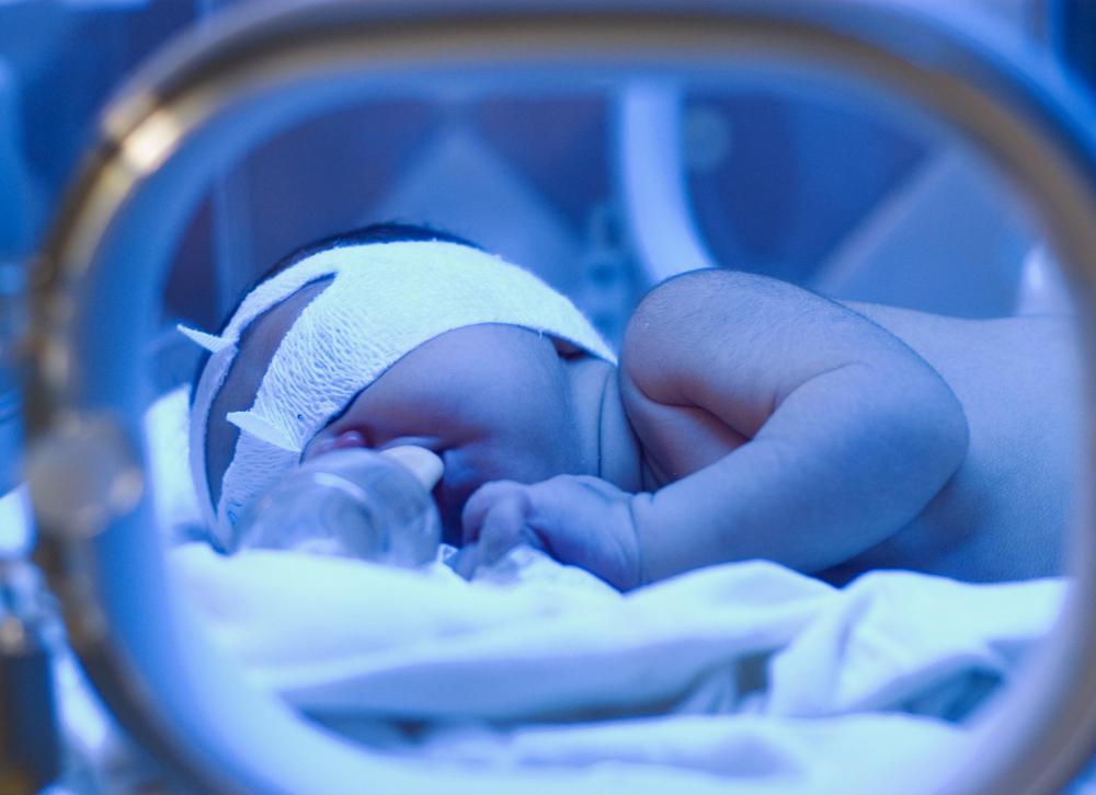 Lanugo is often still present on premature babies.
