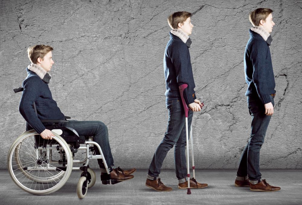 Nerve damage may cause temporary paralysis in some individuals.