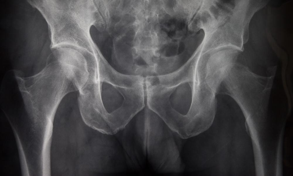 Radiologic technologists can use good techniques to reduce secondary radiation from examinations.