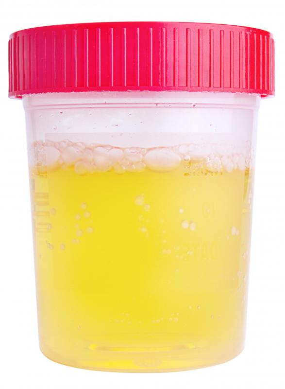 The body gets rid of most of its urea through urine.