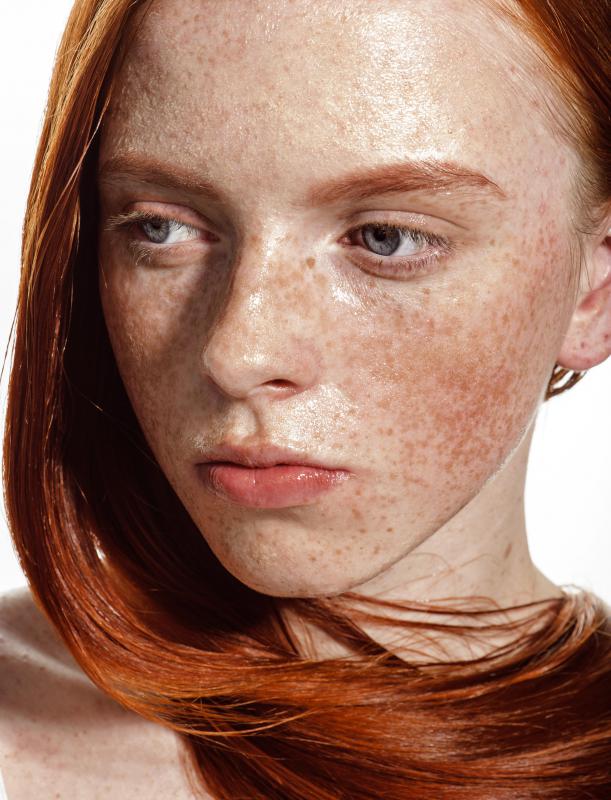 A self-tanning lotion is the safest way to tan with freckles.