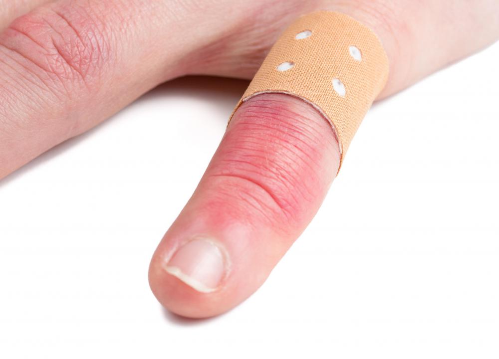 The healing action of monocytes causes the heat and swelling associated with infections.