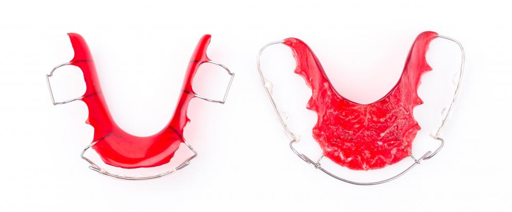 Orthodontists may use retainers to correct minor dental issues, or to keep teeth in place after braces are removed.