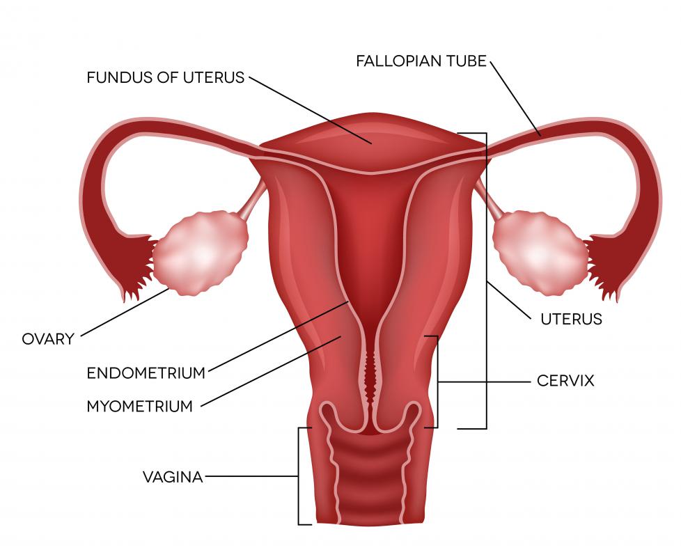In the treatment of ovarian cancer, chemotherapy medications bathe the entire abdominal cavity to eliminate any metastases, including growths too small to identify.