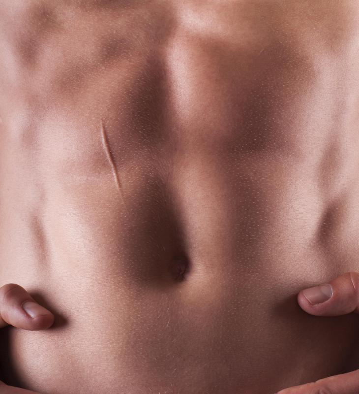 Certain neuropeptides help to heal scars.