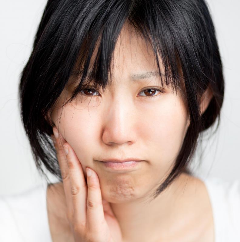 When wisdom teeth become impacted, they are typically removed.