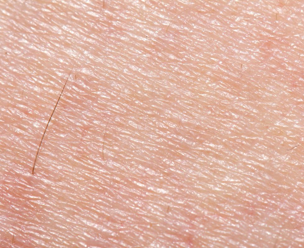 Epithelial tissue makes up the body's skin.