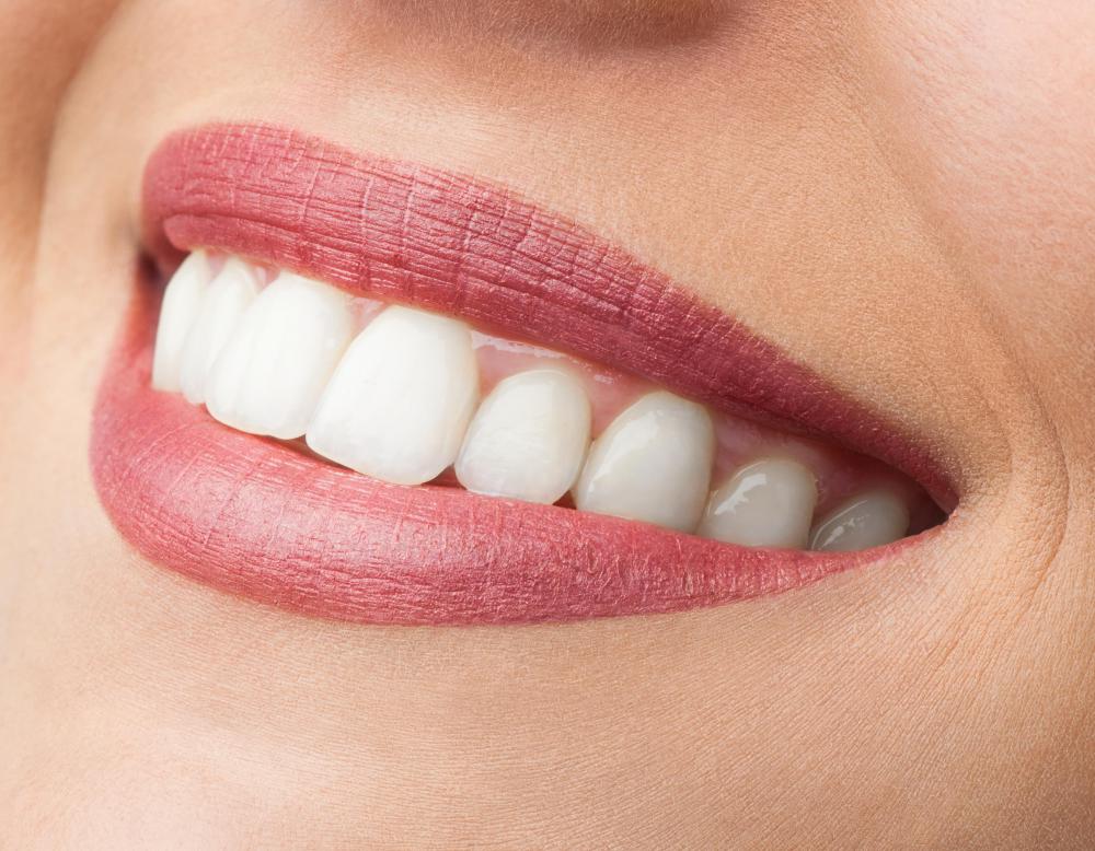 Practicing smiling can help improve the smile muscles.