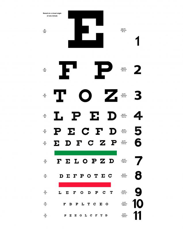 Visual impairment occurs when a person's vision cannot be corrected to 20/20.