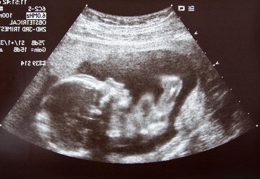 Sonograms can reveal the growing features of the fetus.
