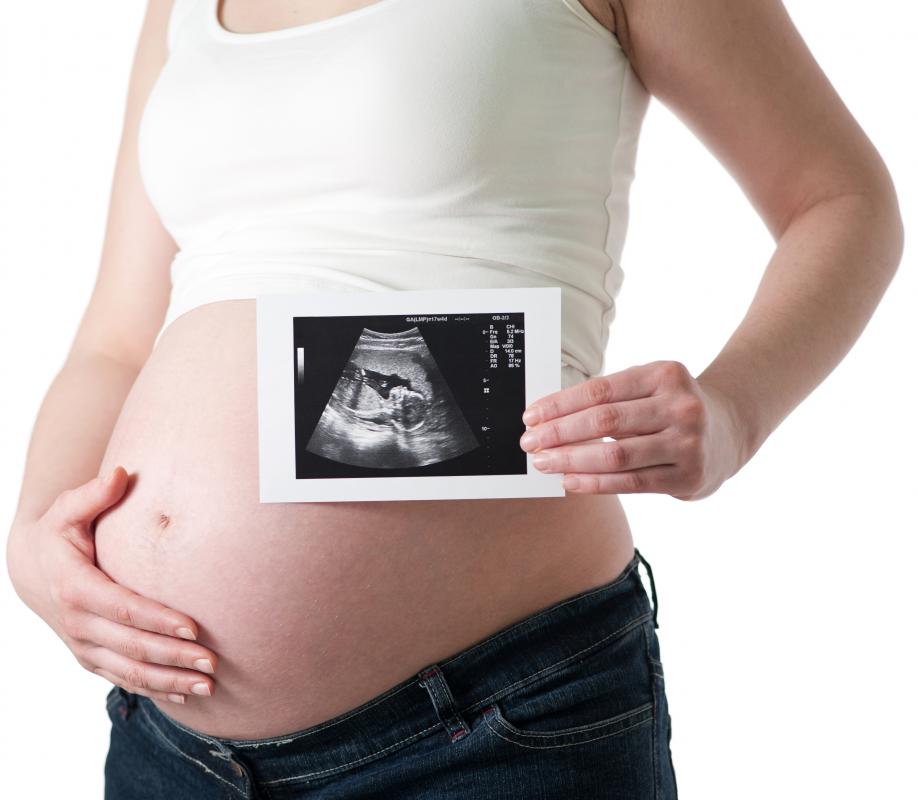 Ultrasound technology uses ultrasonic waves to sense and image internal organs or unborn children.