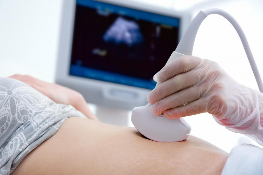 Sonography is the use of a sonogram machine that uses high frequency sound waves to obtain a real time image of the inside of the body.