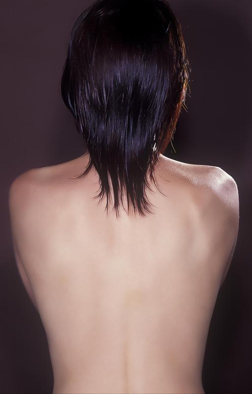 Thoracolumbar scoliosis occurs more often in females than in males.