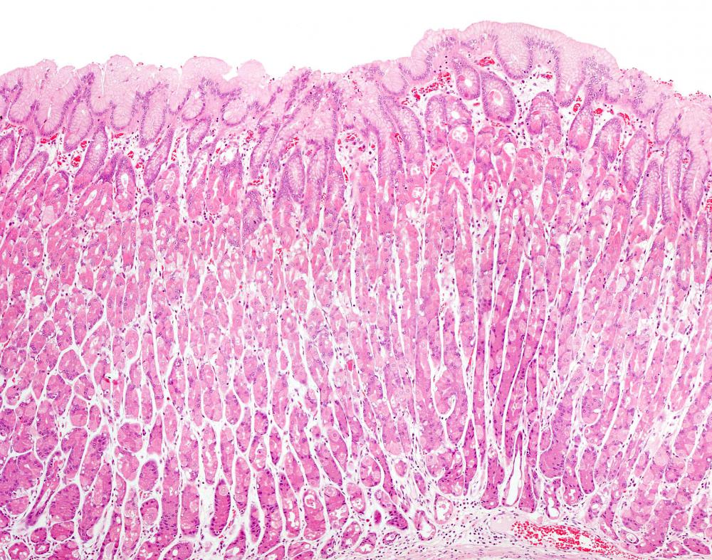 P/D1 cells, that produce the hormone ghrelin, are part of the stomach lining.