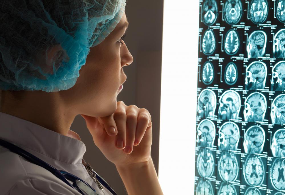 Neurosurgery is treatment of the brain with surgery.