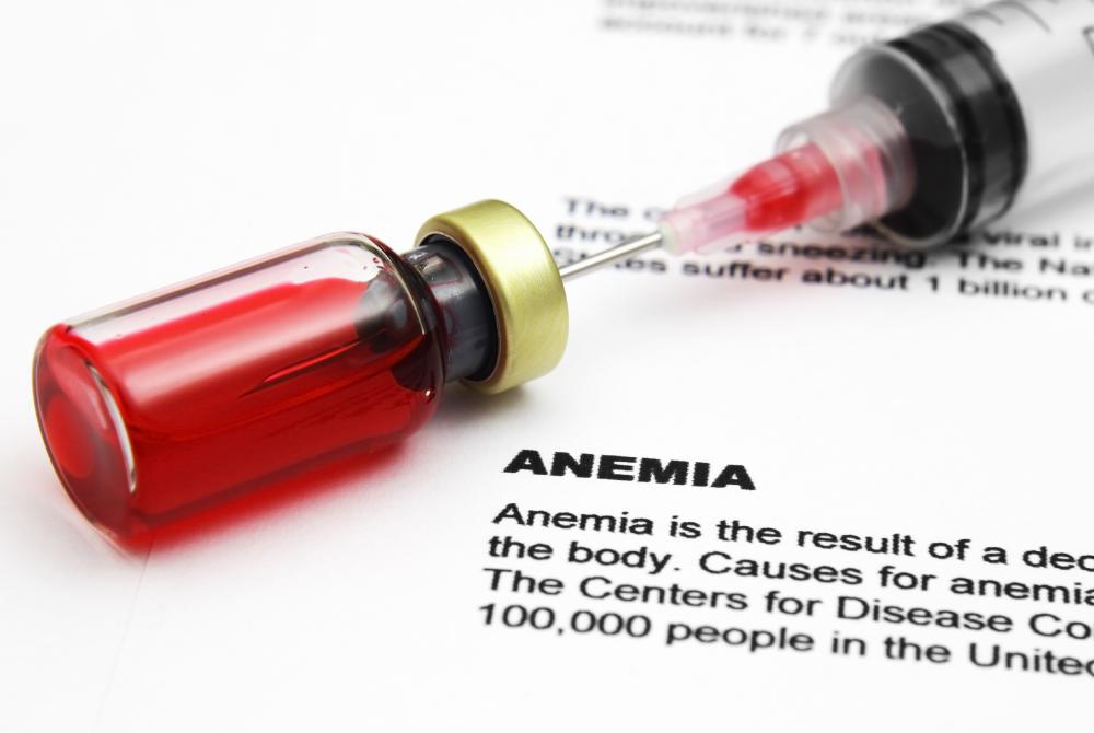 Anemia occurs when the hemoglobin content in red blood cells is too low to provide the body with oxygen.