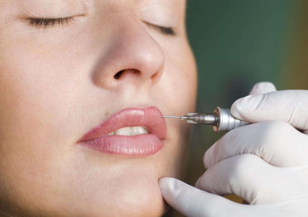 A permanent lip liner tattoo might be applied to the vermilion border.